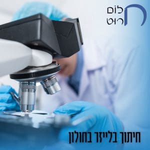 חיתוך בלייזר חולון